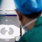 Preporuke za hronične bolesnike u vrijeme pandemije Covid-19